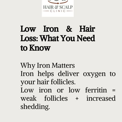 Low iron = high hair loss.
Ferritin is the “fuel tank” for your hair. When it’s low, shedding increa