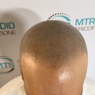 L’effetto finale non dovrebbe mai sembrare un tatuaggio.

✔️ Nessun filtro
✔️ Nessun effetto artific