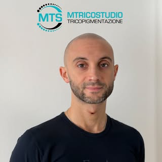 Rasarsi i capelli non basta. Sentirsi di nuovo bene con la propria immagine è tutta un’altra cosa.


