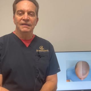 Philadelphia Hair Restoration  610-668-3300