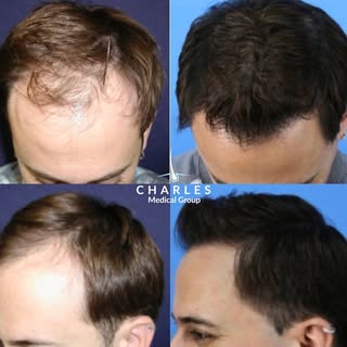 Patient results are what we're here for ✨👏
ㅤ
Learn more about how Dr. Charles can help you achieve 