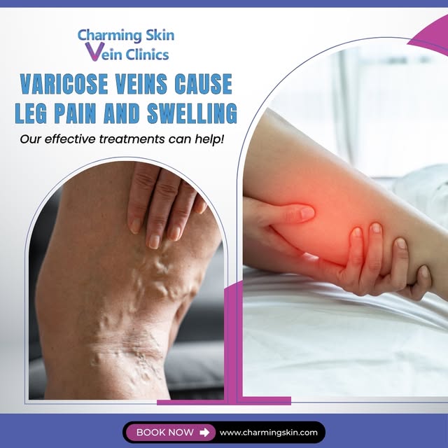 Varicose veins cause leg pain and swelling. Our effective treatments can help!

Explore your options