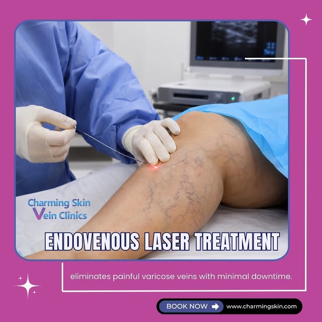 Endovenous Laser Treatment eliminates painful varicose veins with minimal downtime.

Ready for beaut