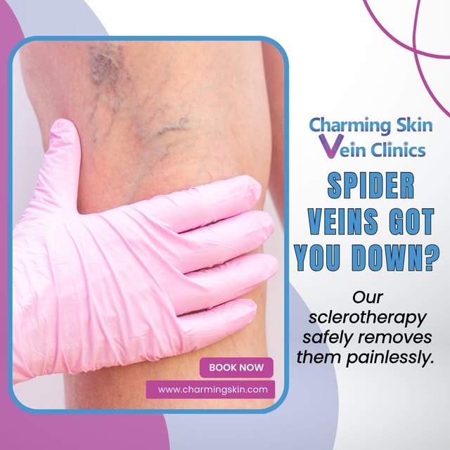 Spider veins got you down? Our sclerotherapy safely removes them painlessly.

Reclaim your confidenc