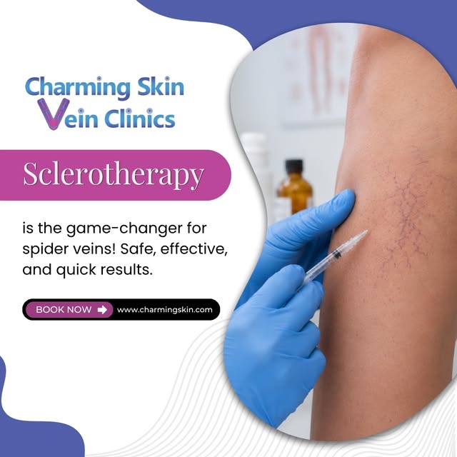 Sclerotherapy is the game-changer for spider veins! Safe, effective, and quick results.

Start your 