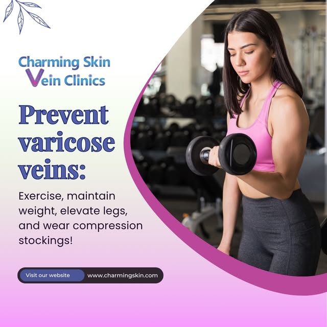 Prevent varicose veins: Exercise, maintain weight, elevate legs, and wear compression stockings! 🚶♀