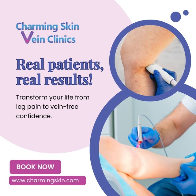 Real patients, real results! Transform your life from leg pain to vein-free confidence.

Book your c