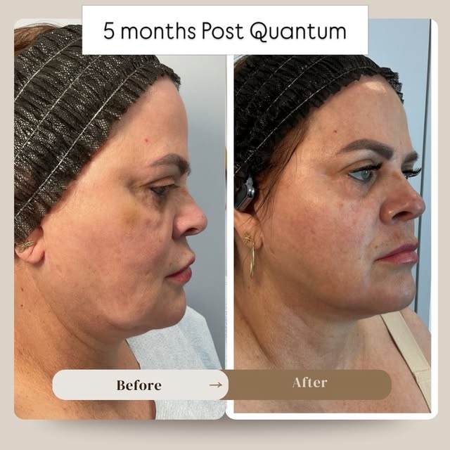 🔥 Quantum & Morpheus for the Win 🔥  The best results don’t always happen overnight. ✨

This is wha