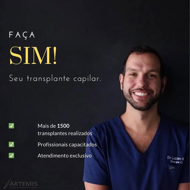 FAÇA SIM SEU TRANSPLANTE CAPILAR. Nossa equipe já realizou mais de 1500 transplantes bem sucedidos ,
