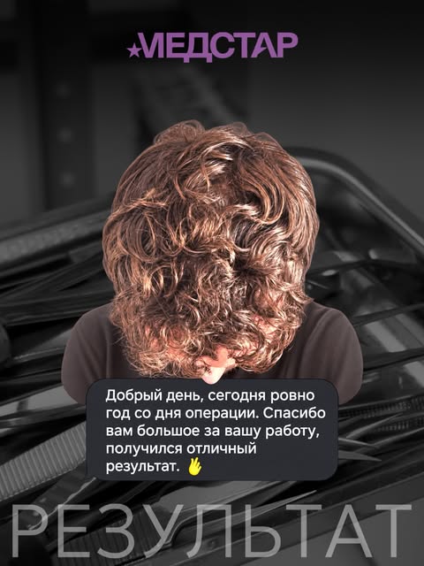 Ровно год между «до» и «спасибо, получился отличный результат».

Пересадка волос — это долгосрочное 