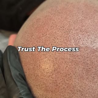 The key to GREAT looking SMP.....is to trust the process. 

You can be as impatient as you want - wo