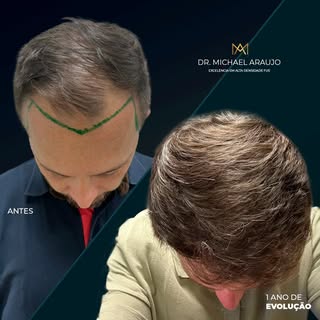 A mudança vai além da estética! Transformações reais que impactam autoestima e confiança.

O antes e