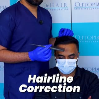 തിരികെ നേടാം നിങ്ങളുടെ പഴയ രൂപം.

 Hairline Correction ലൂടെയും Density Improvement ലൂടെയും ഒരു മികച്