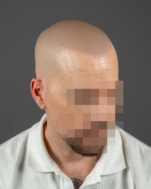 Hay una edad en la que uno deja de mirarse el pelo por costumbre y empieza a mirárselo con lupa. Ahí