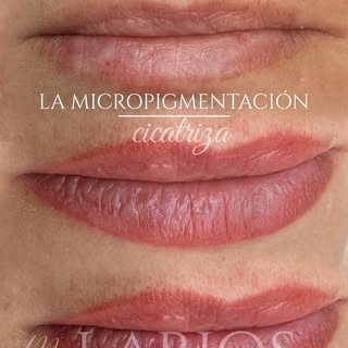 💋 Los labios no tienen que verse maquillados para verse bonitos.

✨ La micropigmentación de labios 