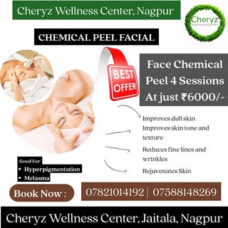 Chemical Peel Facial 
#chemicalpeel #chemicalpeeling #nagpur #wellness #beauty #aesthetic #clinic 


