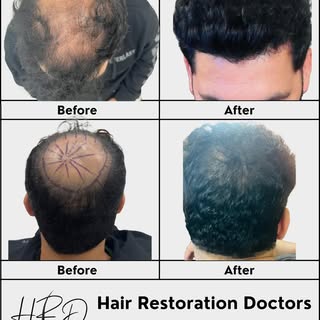 Scroll through Mr R’s amazing results! Our interstate patient from Brisbane recently shared his 18-m