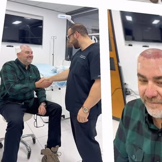 Enjoy our patients transformation with Dr Assem & team, over 3000 grafts, long but relaxing day for 