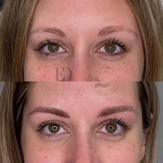 ✨ Antes y después de una transformación sutil pero poderosa ✨

Nuestra clienta llegó con cejas rubia