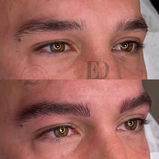 🔹 Antes & Después – Micropigmentación pelo a pelo en cejas masculinas 🔹
En este caso, no buscamos 