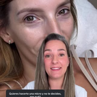 Respondiendo algunas de vuestras inquietudes a la hora de realizaros uña Micropigmentación.

En este