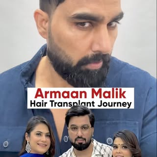 Bigg Boss Fame Armaan Malik Hair Transplant Journey| QHT Clinic
@armaan__malik9

Ping Us : +91-98970