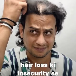 🇮🇳 This Independence Day, Get Freedom from Hair Loss! ✨

#qht #hairtransformation #hairtransplant 