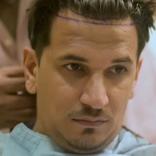 Prince Narula’s Hair Transplant Journey 

#qht #hairtransformation #hairtransplant  #pricenarula #re