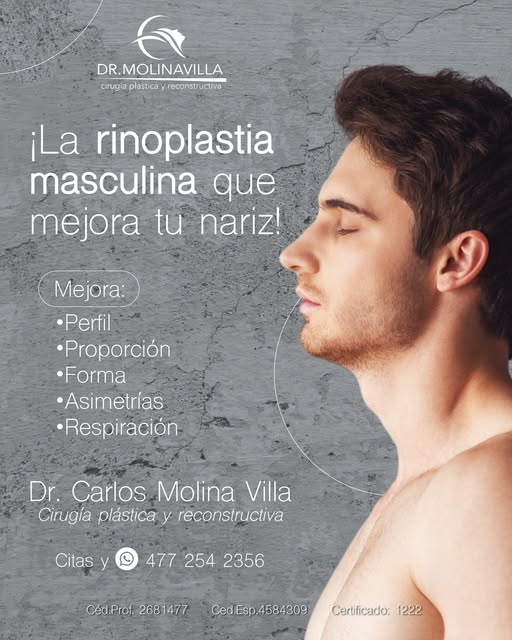 La rinoplastia masculina no busca cambiar tu identidad, sino lograr una nariz que armonice con tus r