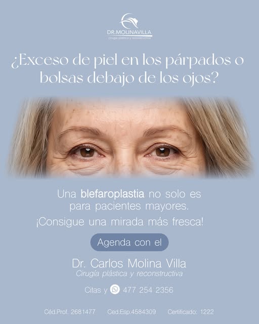 Muchas personas creen que la blefaroplastia solo es para pacientes mayores, pero la realidad es que 