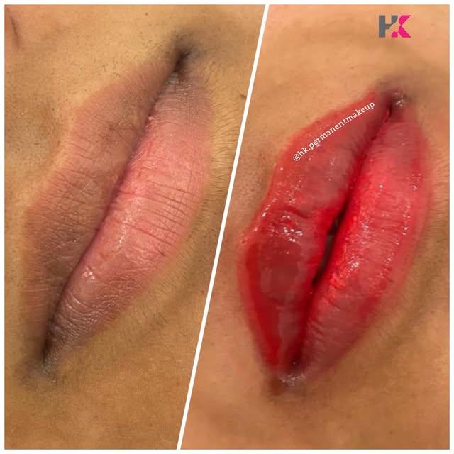 Dark lips can quietly affect confidence in ways most people never talk about. 

Our Dark Lip Color C