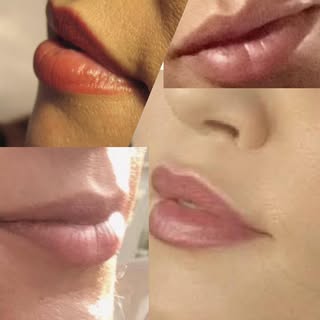 LIPS - Dr. Hal London 

Four photos of two ladies, nice examples of lips after enhancement. Natural 