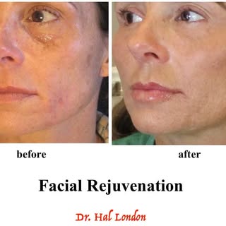 ENJOY YOUR SUMMER- Dr. Hal London 

Time is my most precious commodity. I can’t  make more of it and