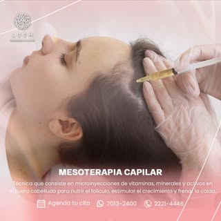 Procedimiento estético que consiste en la aplicación de microinyecciones con vitaminas, minerales, a
