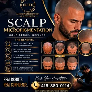 Confidence starts with feeling like yourself again! 
Call 416 880 0114 for your FREE consultation. 
