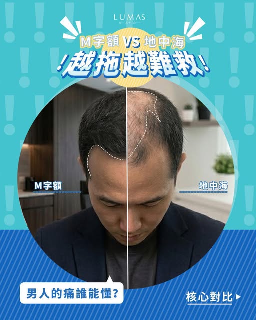 【男人的痛誰能懂？💔】M字額 VS 地中海，越拖越難救！🚨

好多男士一照鏡發覺前額越來越高，或者頭頂開始見到頭皮反光，都會覺得好灰心甚至老尷... 其實「M字額」同「地中海」係最常見嘅男士脫髮痛