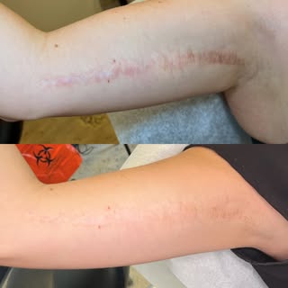 I already shared a reel of this transformation… but these healed results deserved their own moment

