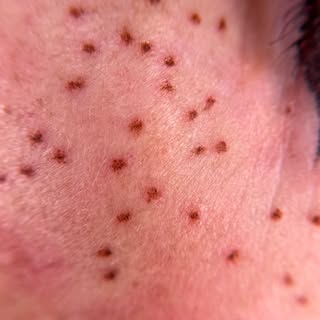 Up close and personal on these fresh frecks ✨

Each freckle is placed with intention, varying depth,