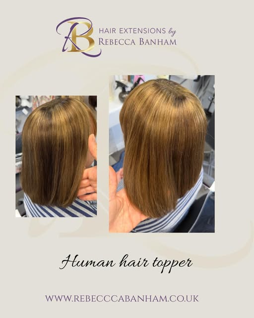 Clients often tell me that having hair loss and being unhappy with their appearance has stopped them