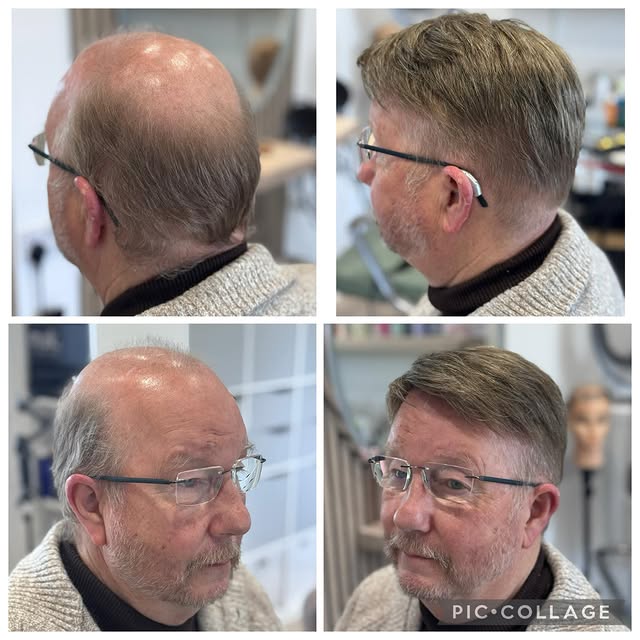 It’s so lovely to be able to offer men’s hair systems, it’s particularly something I really enjoy do
