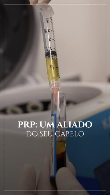 Terapia regenerativa é uma das frentes mais avançadas do tratamento capilar hoje. 

A terapia regene