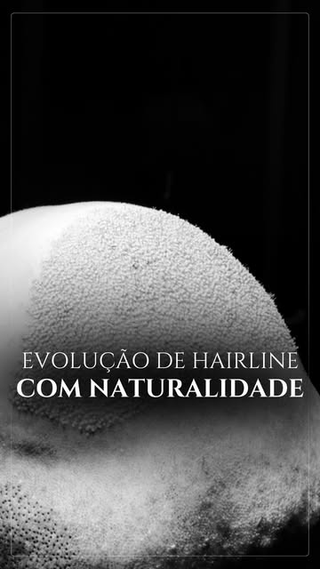 Ver a evolução mês a mês desse paciente resume a excelência da nossa entrega a cada resultado.

Nas 