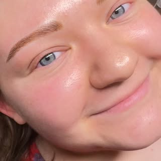 I’m so excited to share this beautiful transformation we did for a lovely client who’s been dealing 