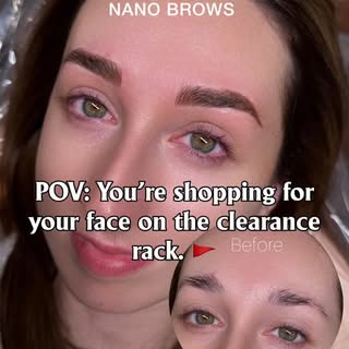 Your face isn’t a seasonal trend you can just return if you don’t like it. 🛑✨ 

I get it—everyone l