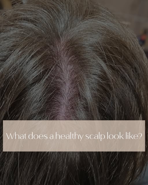 What does a healthy scalp actually look like?

For me, it’s not about having a “perfect” scalp. It’s