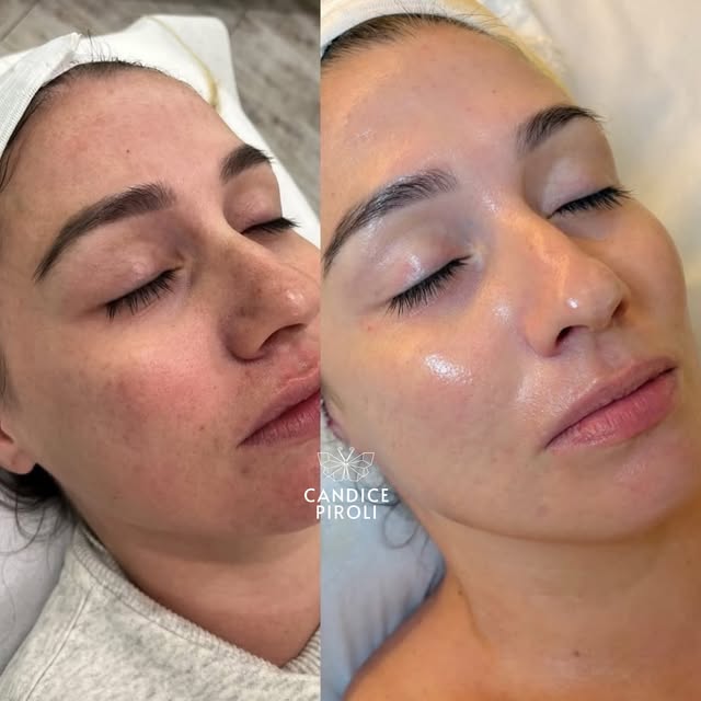 Your daily routine maintains your skin, but monthly facials transform it. 🧖🏽‍♀️ 

Your skin cells 