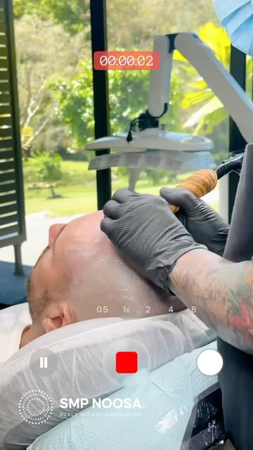 🔥 NEW HAIRLINE = CONFIDENCE REDEFINED 🔥

A natural-looking hairline can completely change the way 