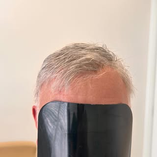 Making hair systems look realistic is key. With most of the concerns we always receive is how to fin