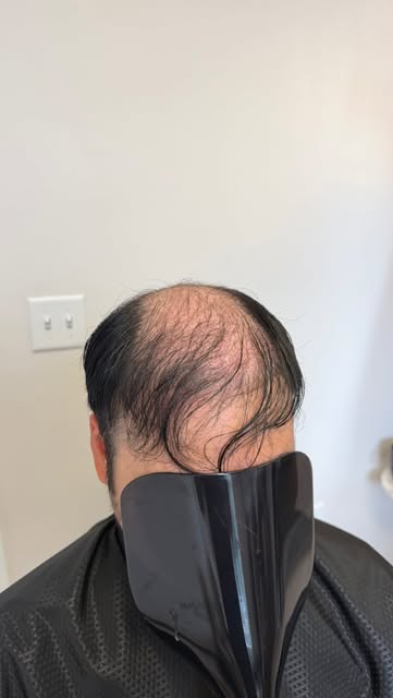 TEXTURE.. let’s talk about. Majority of stock hair systems are Indian and Chinese meaning the hair i