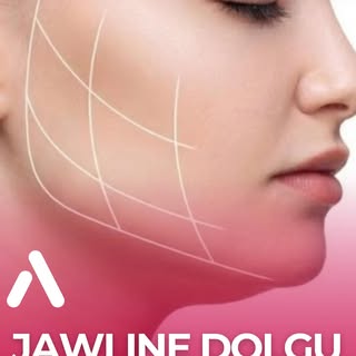 Jawline dolgu gıdıyı yok eder mi?🤔
Cevap net: Hayır.

Jawline dolgusu,
gıdı bölgesindeki yağlanmayı